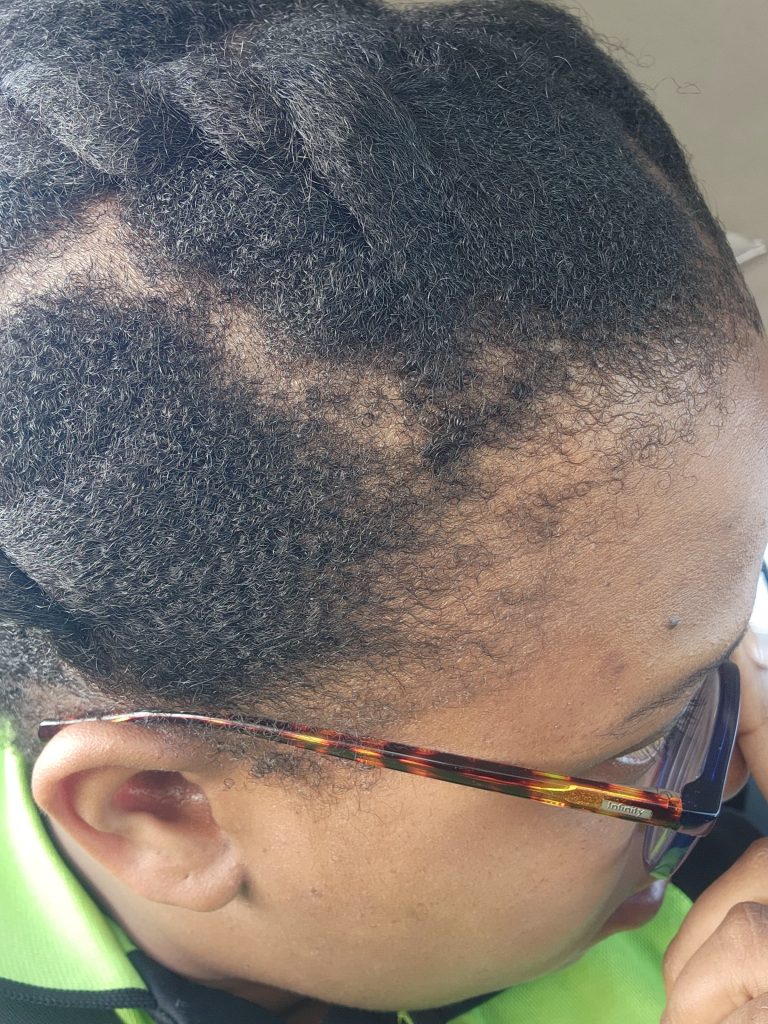 Hygral Fatigue 4C Hair